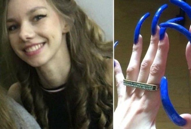 Не все зубы в 14 лет выросли Не все зубы в 14 лет выросли