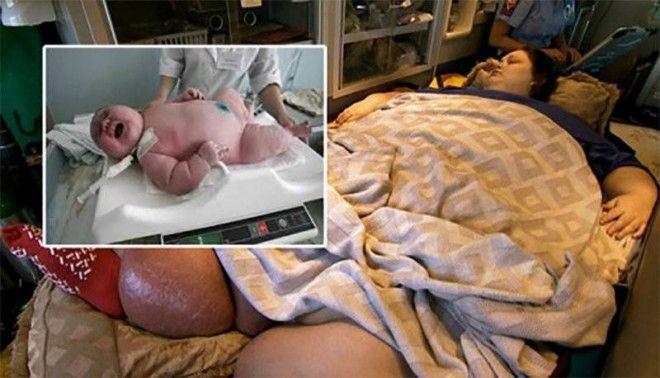 250килограммовая женщина родила ребенка Как думаете сколько он весит