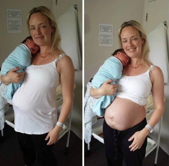 Она выложила свое фото в Сеть спустя 48 часов после родов 