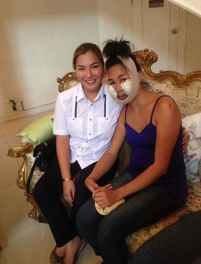 Две женщины 10 лет скрываются от людей изза неудачного похода к косметологу