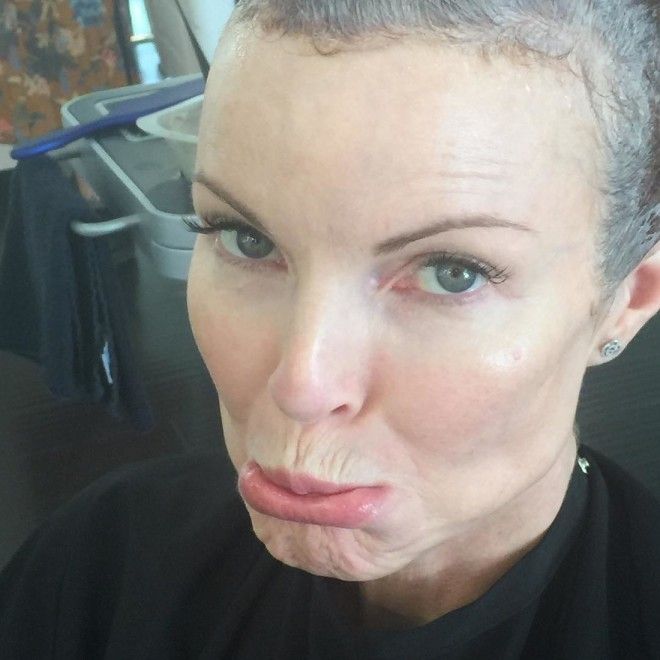 Звезда Отчаянных домохозяек лишилась волос в борьбе с раком 