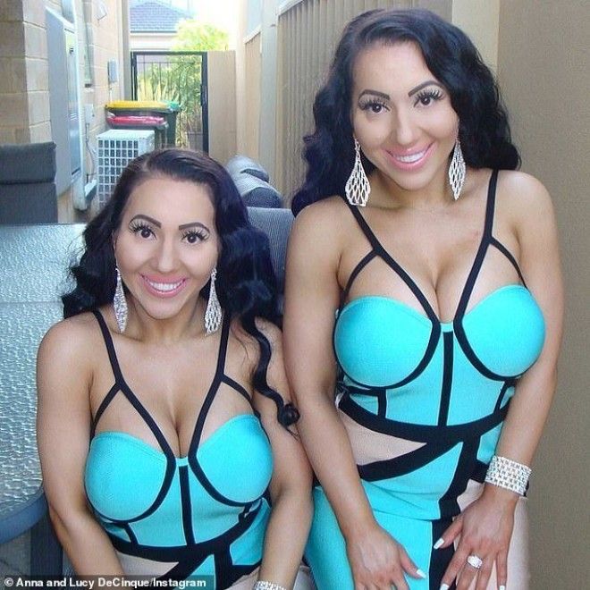 Эти близняшки потратили 250000 на пластику и все равно недовольны собой