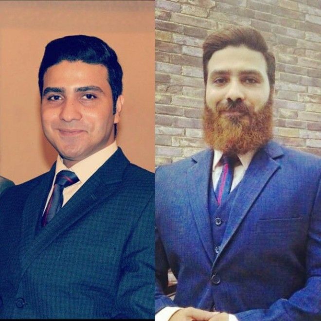 Вот как меняются лица мужчин с бородой и без