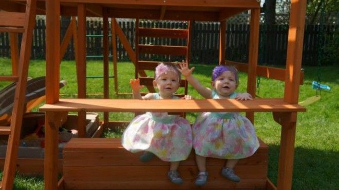 Эти близнецы покорили мир одним лишь снимком при рождении