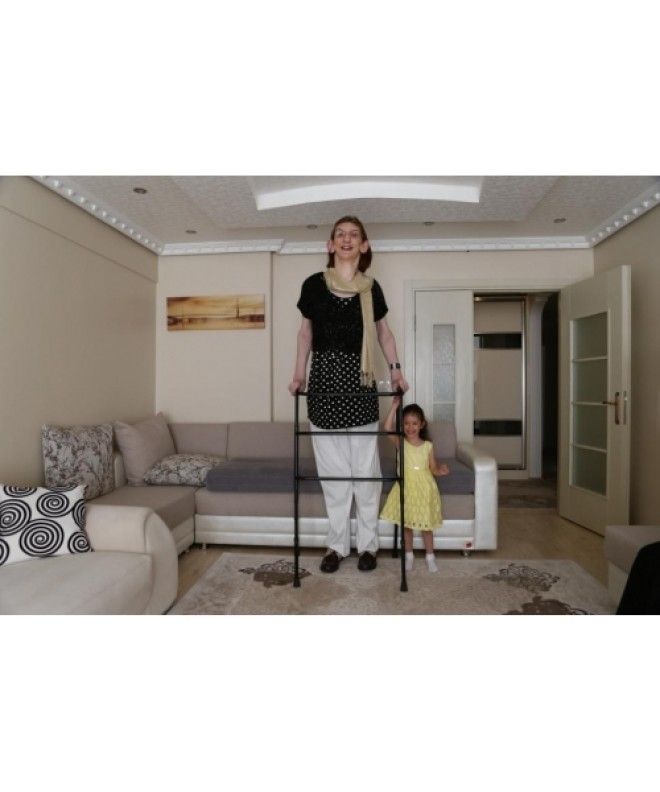 Вот как выглядит и живет самая высокая девушка в мире