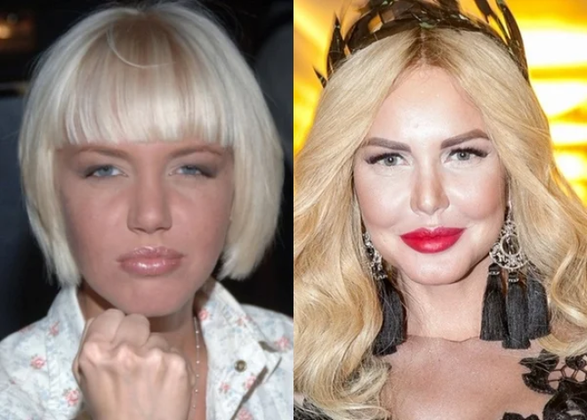 7 знаменитых блондинок которые сделали ринопластику