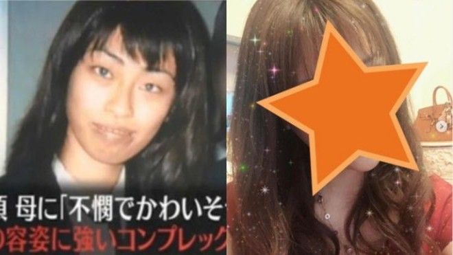 Японская девушка сделала около 300 операций чтобы понравиться своей матери