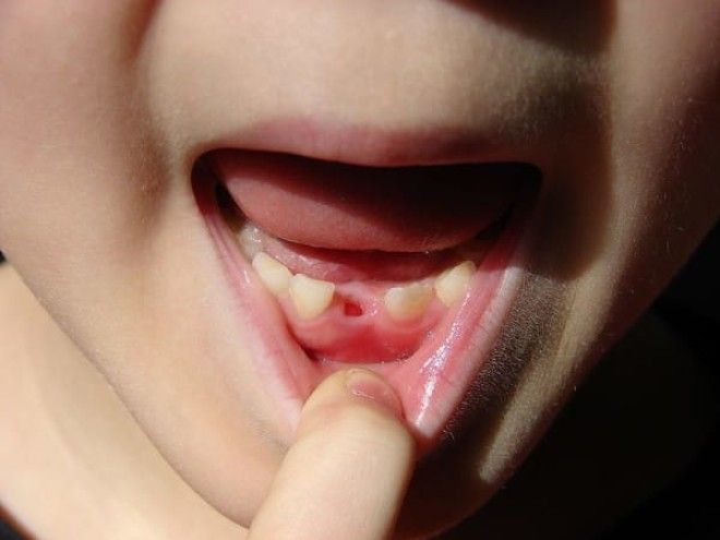 Никогда не выбрасывайте молочные зубы своих детей Вот что говорят врачи