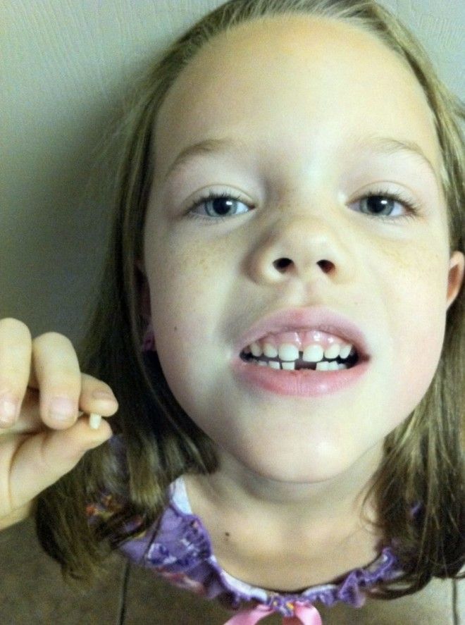 Никогда не выбрасывайте молочные зубы своих детей Вот что говорят врачи