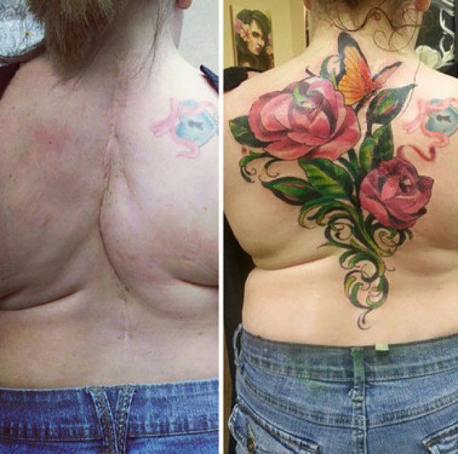 Шрамы украшают татуировки которые превратили недостатки в достоинства
