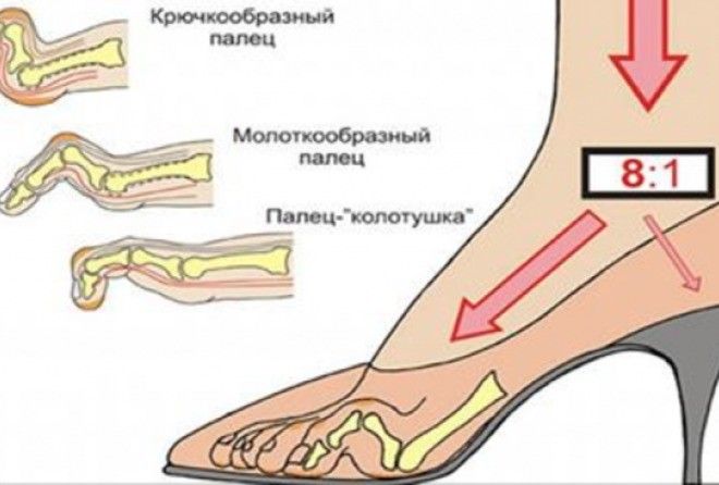 А вы часто носите обувь на высоком каблуке?